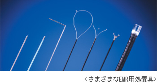 H25.7 最近の早期胃がんの内視鏡治療(ESD)と適応について